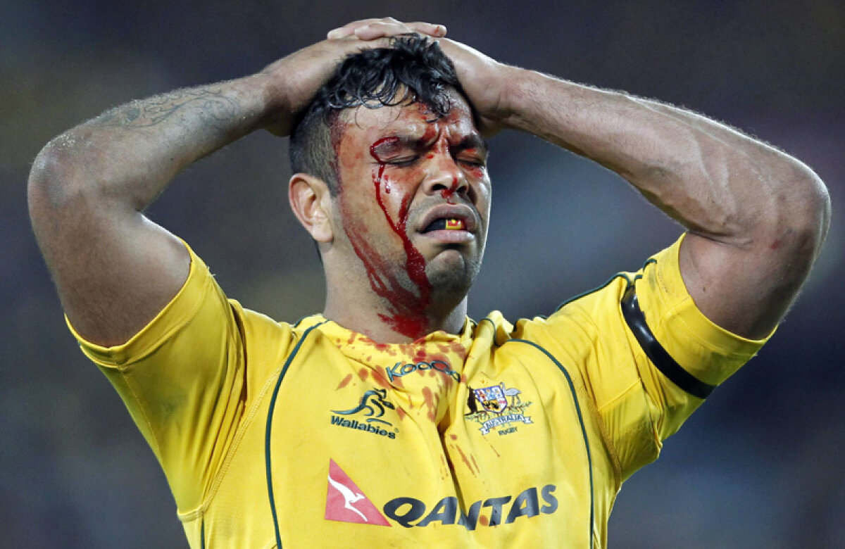 FOTO Fight club! » Week-end teribil în sportul mondial: feţe lovite şi acoperite de sînge