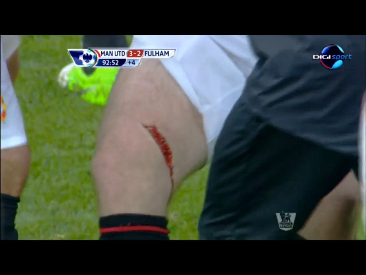 FOTO ŞI VIDEO Nu vrei să vezi aşa ceva! » Accidentare HORROR a lui Wayne Rooney