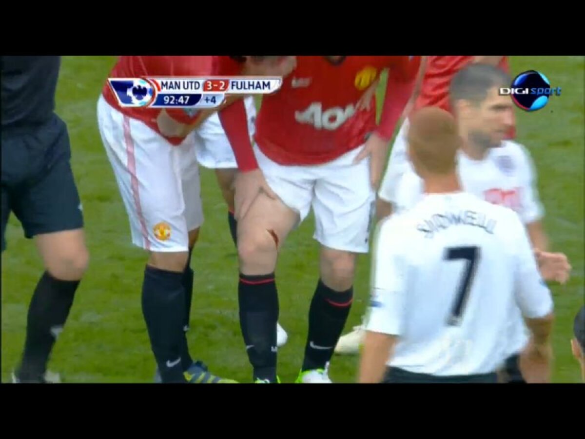 FOTO ŞI VIDEO Nu vrei să vezi aşa ceva! » Accidentare HORROR a lui Wayne Rooney