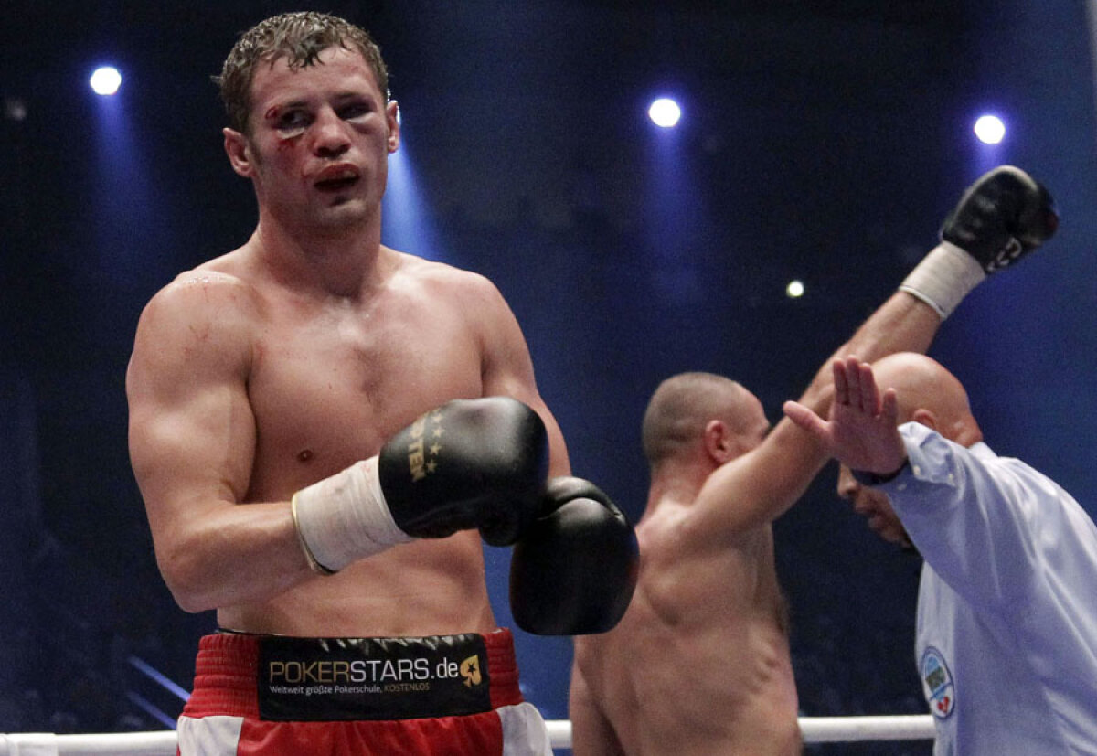 Rana care îl elimină? » Grav accidentat, Rooney ar putea fi vîndut de Man. United!