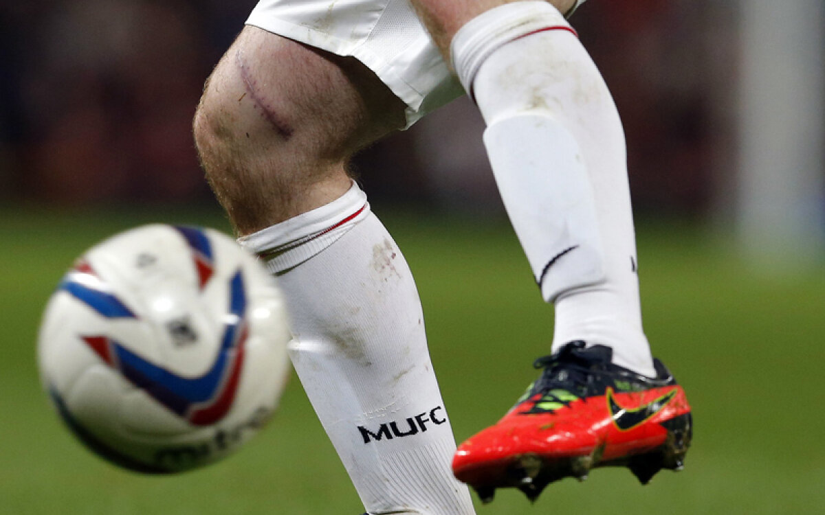 Cicatricea care şochează » 10 puncte de sutură pentru Rooney şi o imagine impresionantă