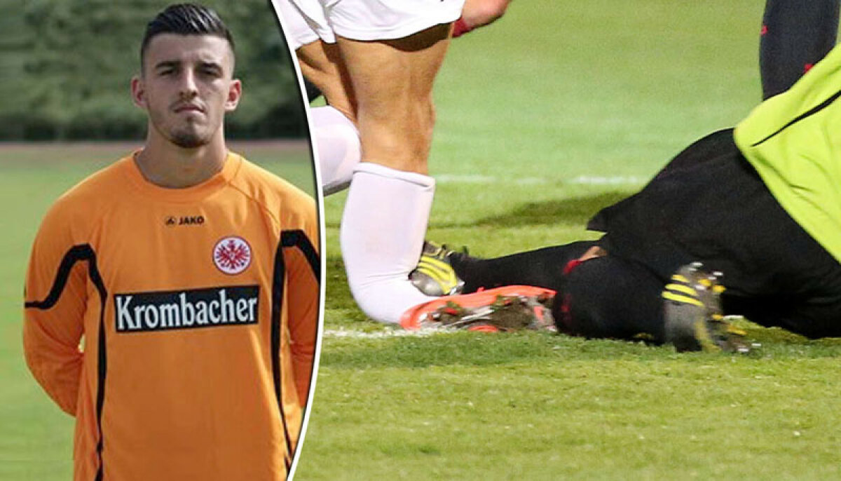 FOTO Fotbalul întunecat de două accidentări-horror! » Picior rupt ca un vreasc