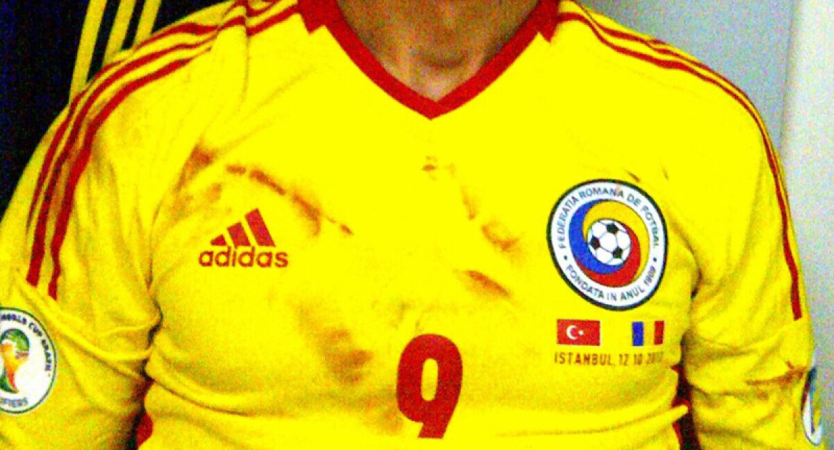 FOTO Cu tricoul însîngerat şi cu sufletul » Filmul victoriei de vis de la Istanbul în imagini