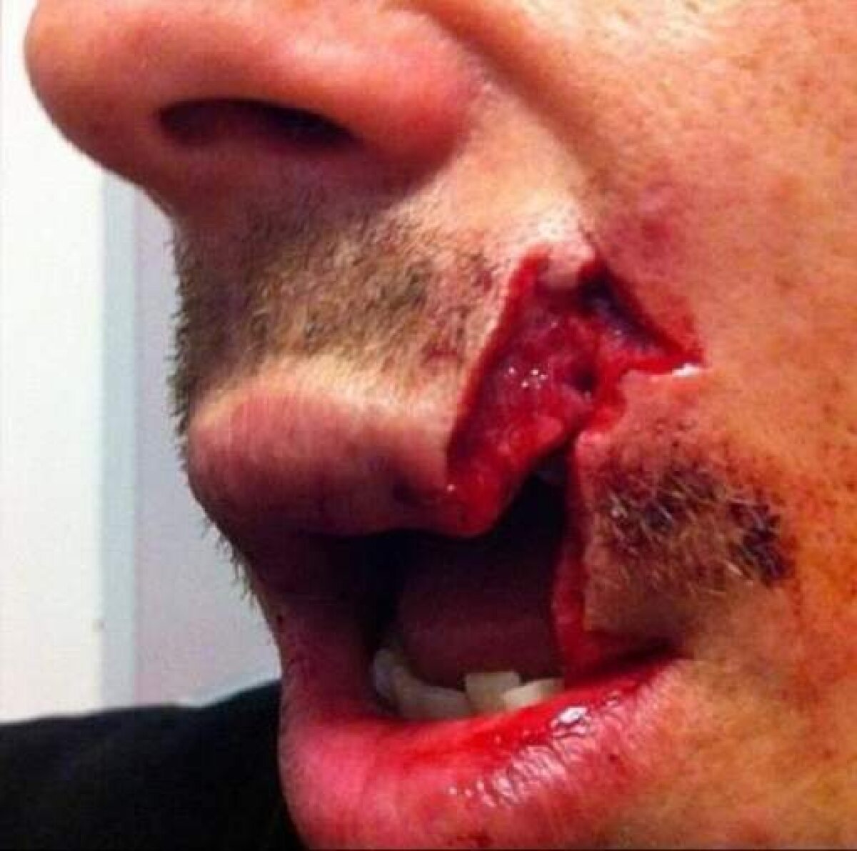 VIDEO Accidentare teribilă pentru un jucător de rugby » A rămas fără o bucată din buză! Atenţie, imagini horror!