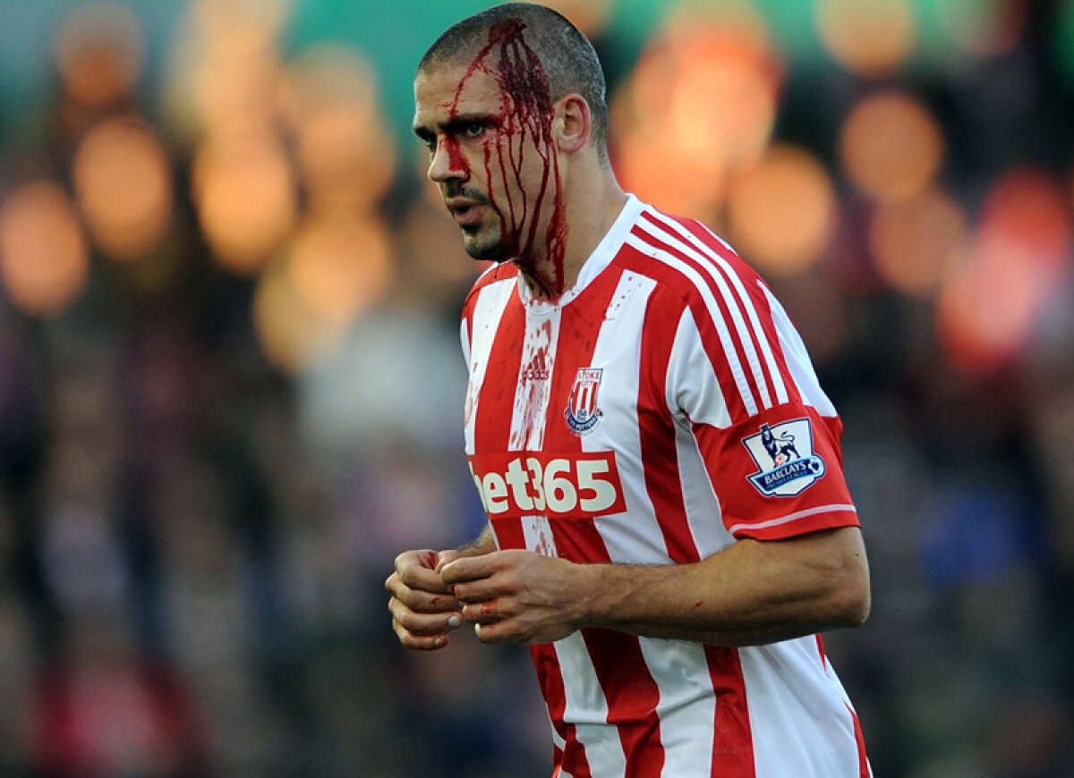 Survivor » Jon Walters, omul care joacă pentru Stoke cu capul spart. De două ori într-un an!