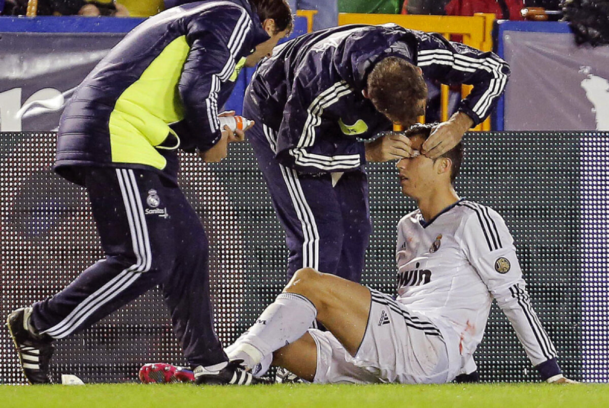 FOTO&VIDEO Ronaldo, eroul lui Real » I s-a spart arcada, a fost cusut pe teren şi a marcat deşi avea dureri mari de cap!