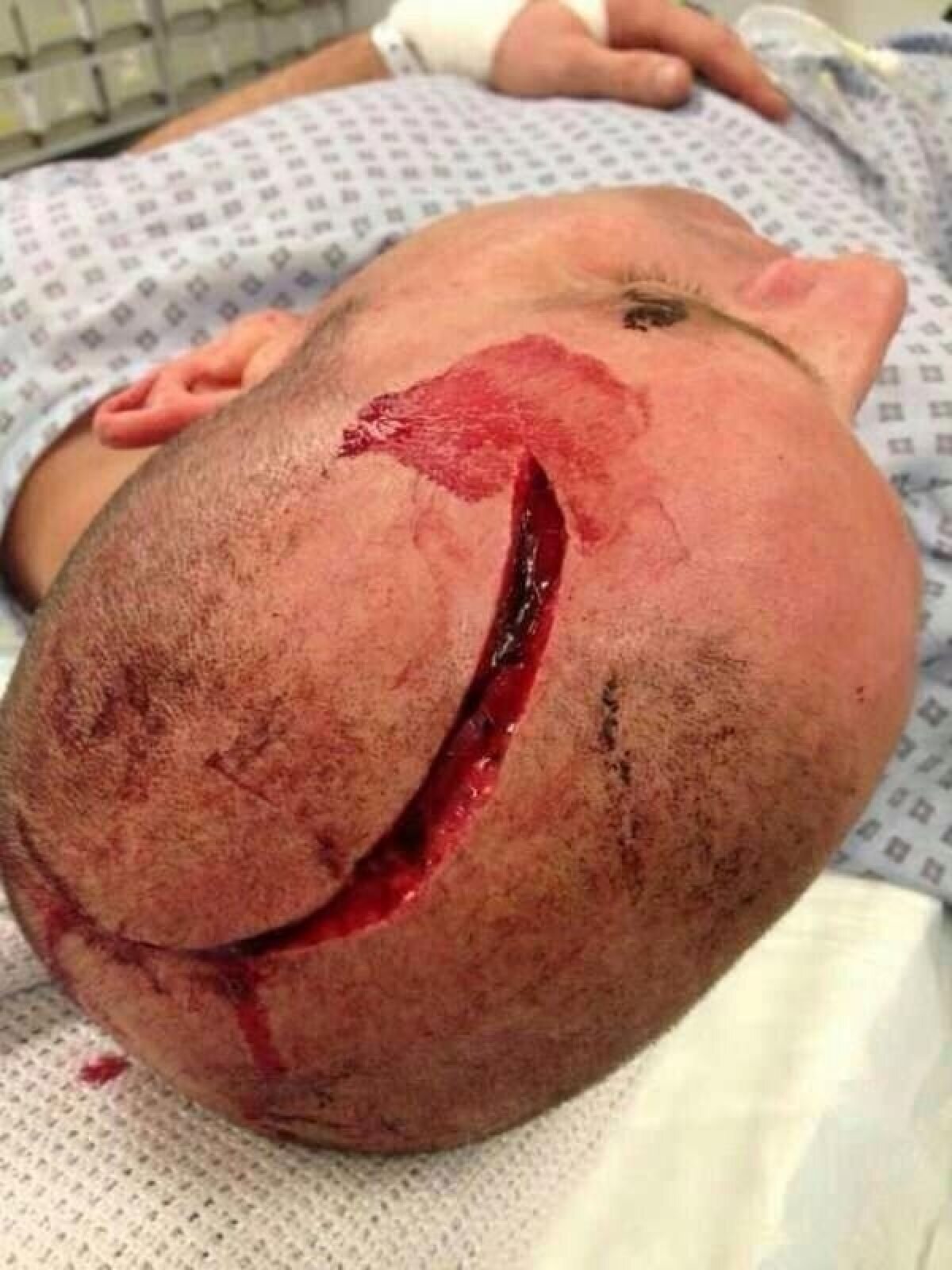 VIDEO Horror League » Violenţe ieşite din comun la meciurile de la Roma şi Marseille