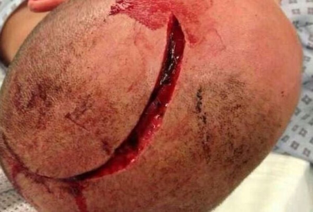 VIDEO Horror League » Violenţe ieşite din comun la meciurile de la Roma şi Marseille