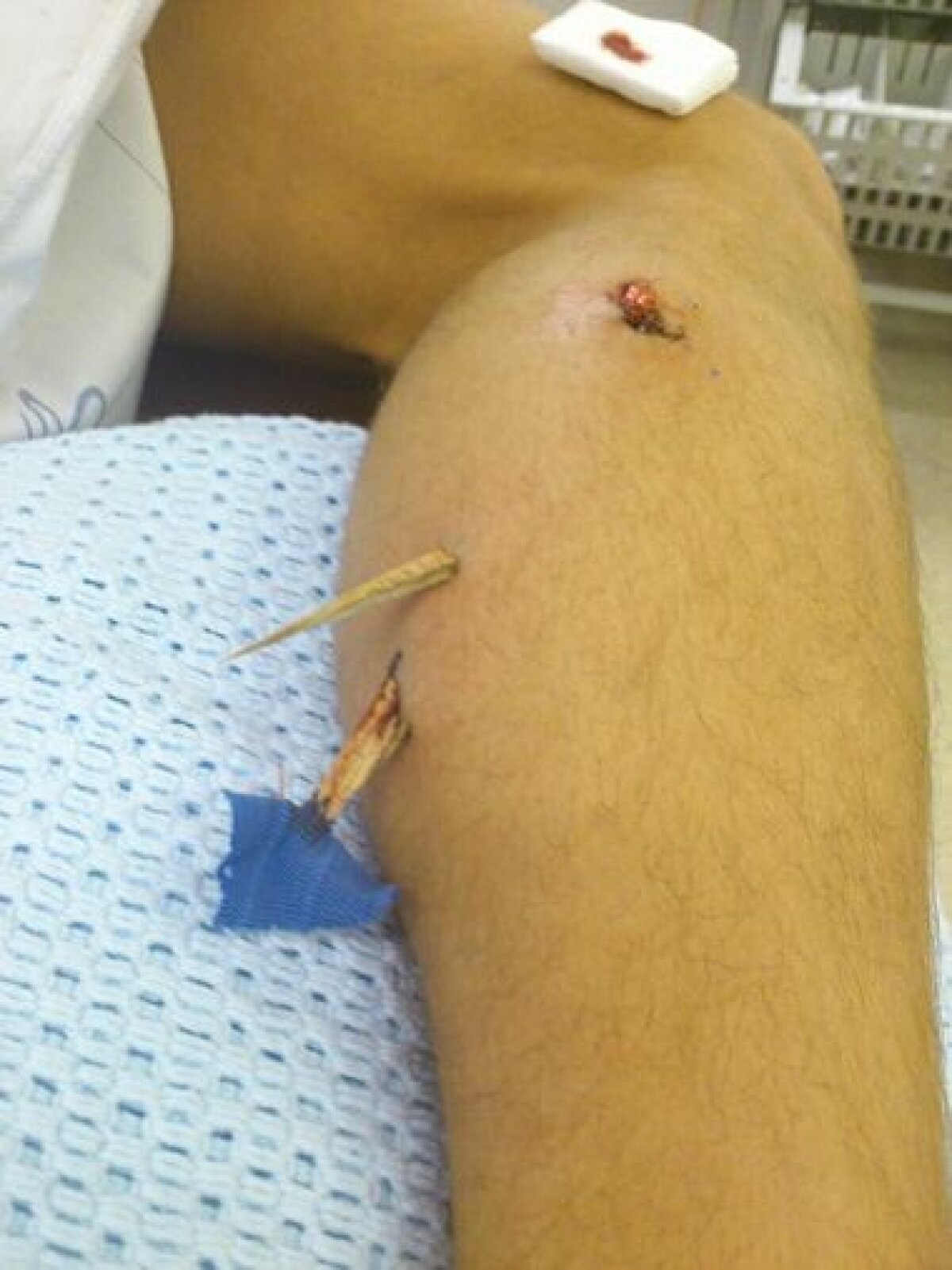 FOTO Accidentare teribilă la futsal » "Cînd mi-am privit piciorul era să leşin"