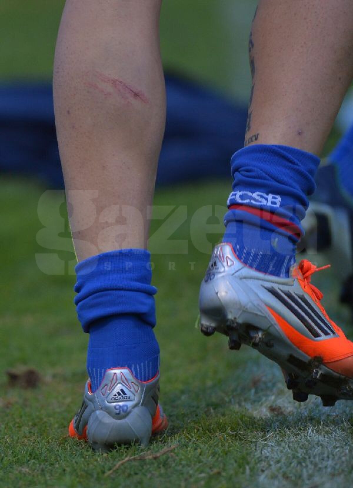 Buletin medical din Marbella » Cum se recuperează "loviţii" Stelei