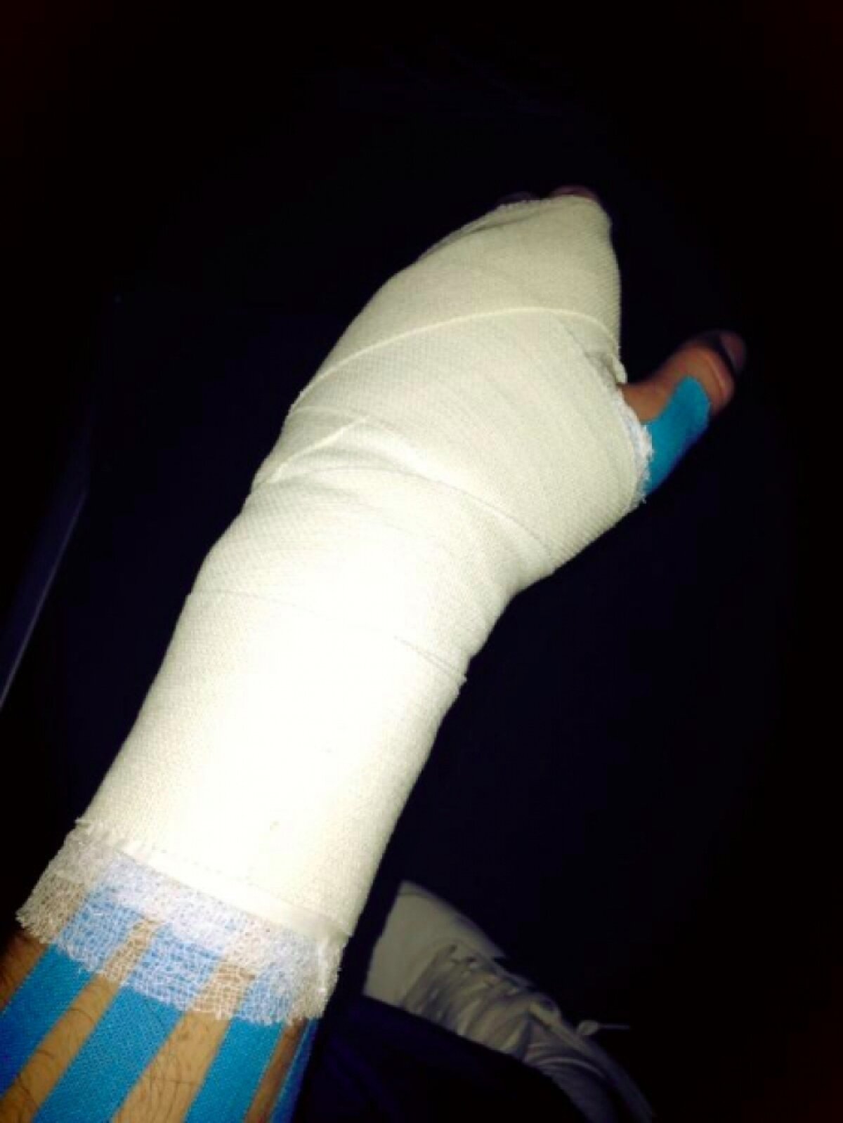 Real fără braţe » Veşti crunte pentru madrileni! Cît va absenta Casillas