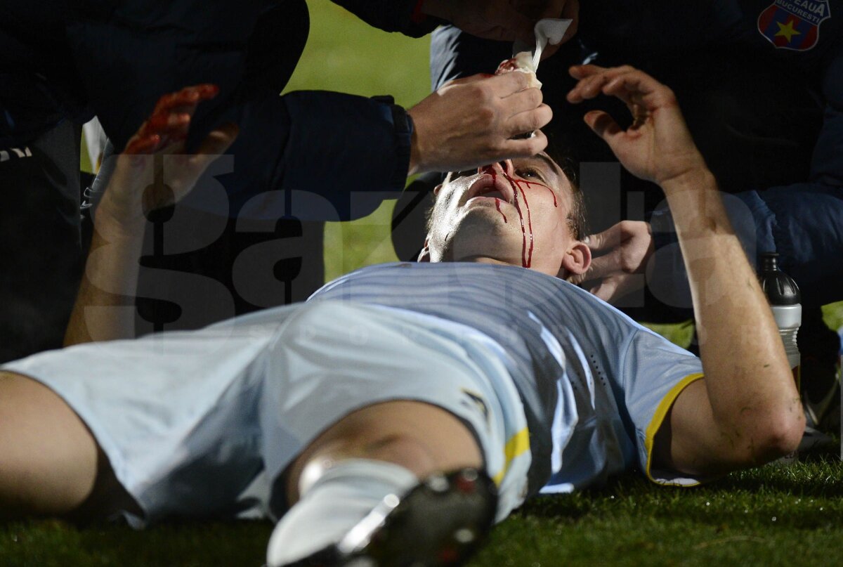 UPDATE Szukala are fractură de piramidă nazală şi ar putea rata "dubla" cu Ajax