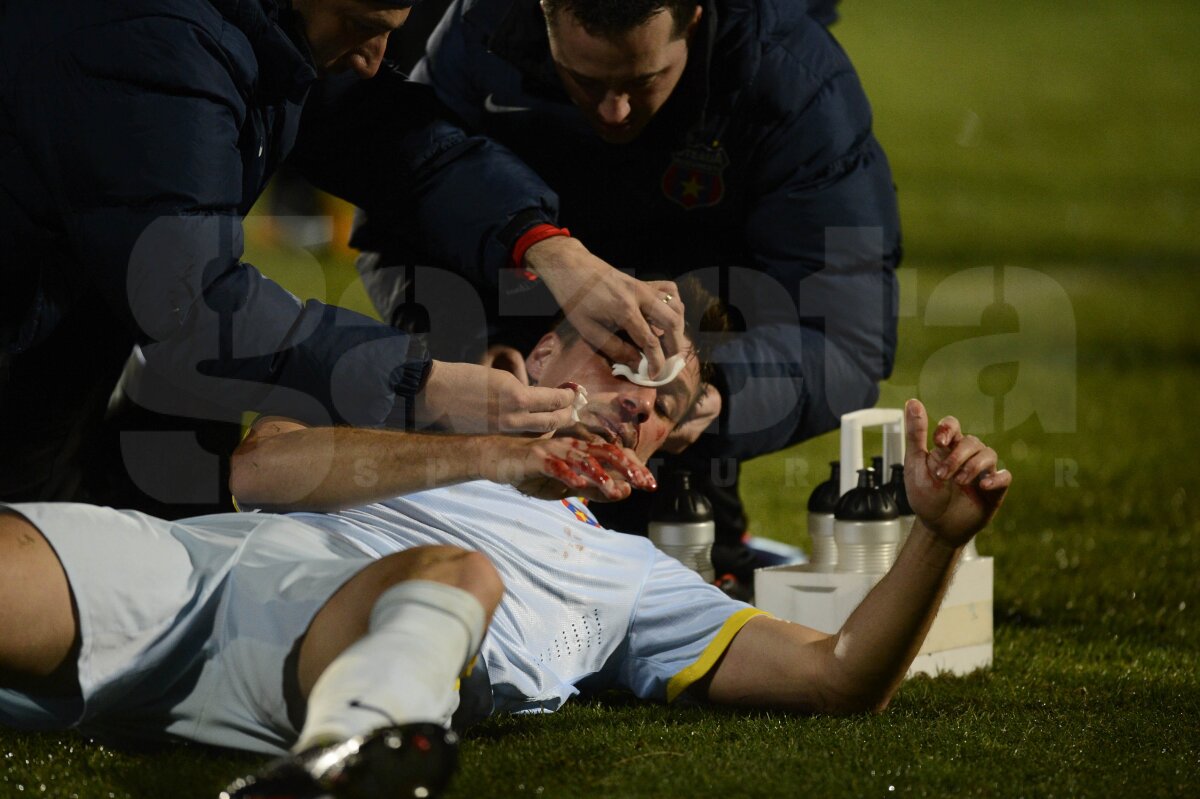 UPDATE Szukala are fractură de piramidă nazală şi ar putea rata "dubla" cu Ajax