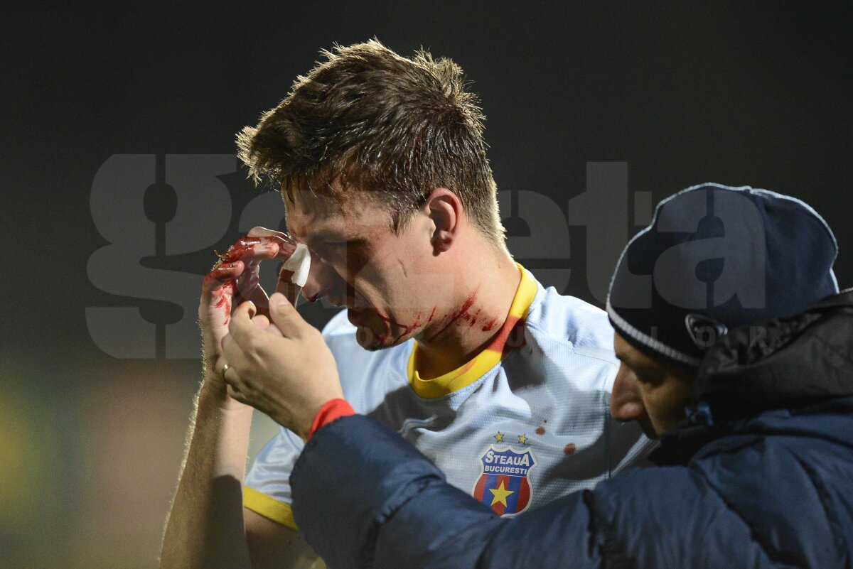 UPDATE Szukala are fractură de piramidă nazală şi ar putea rata "dubla" cu Ajax