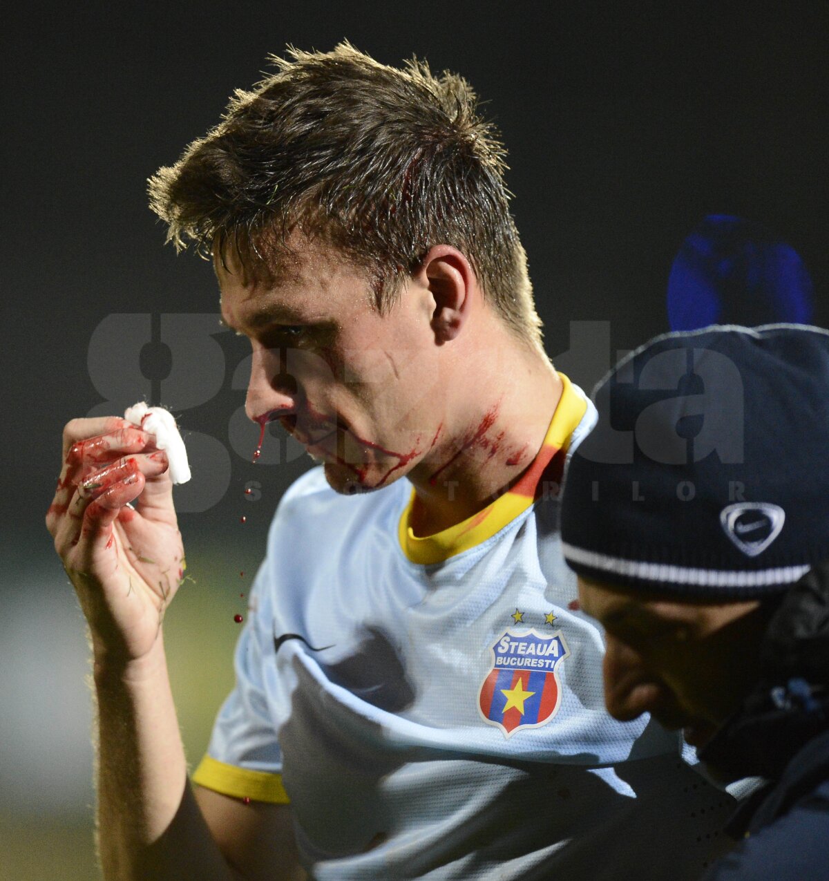 UPDATE Szukala are fractură de piramidă nazală şi ar putea rata "dubla" cu Ajax