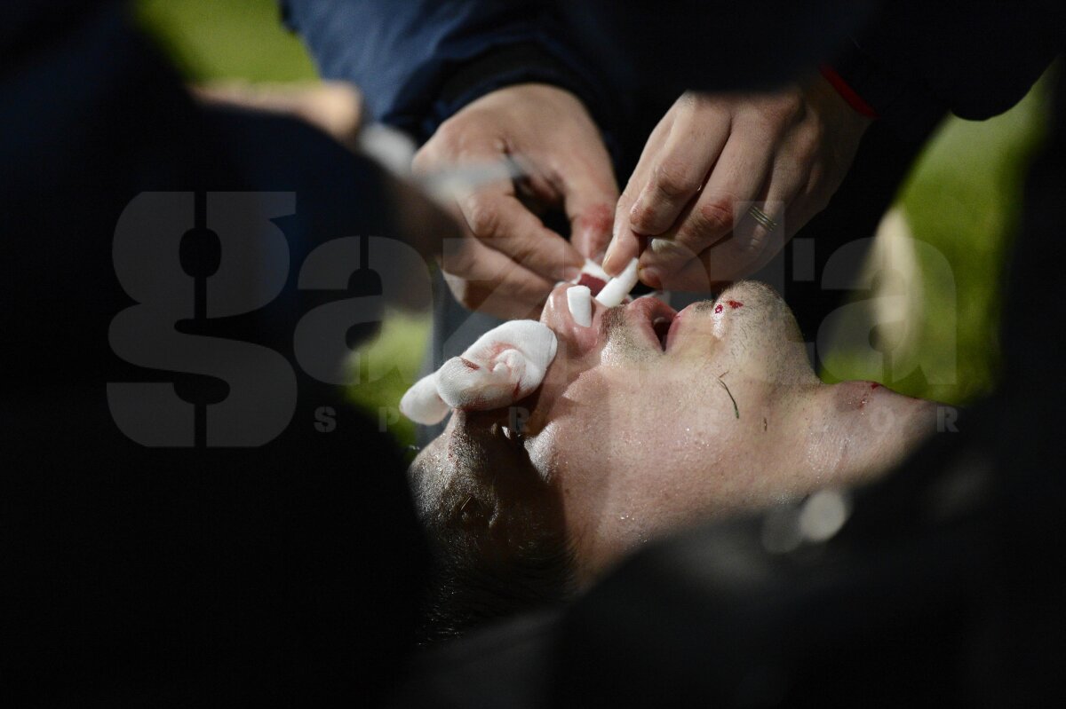 UPDATE Szukala are fractură de piramidă nazală şi ar putea rata "dubla" cu Ajax