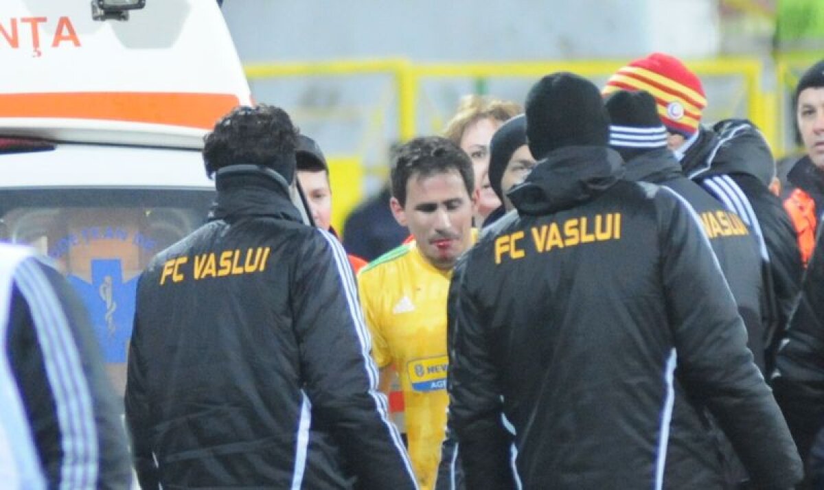 UPDATE Desfigurat de Cadu, Milanov a refuzat să-şi pună dinţii în ţară » Noi acuze la adresa agresorului