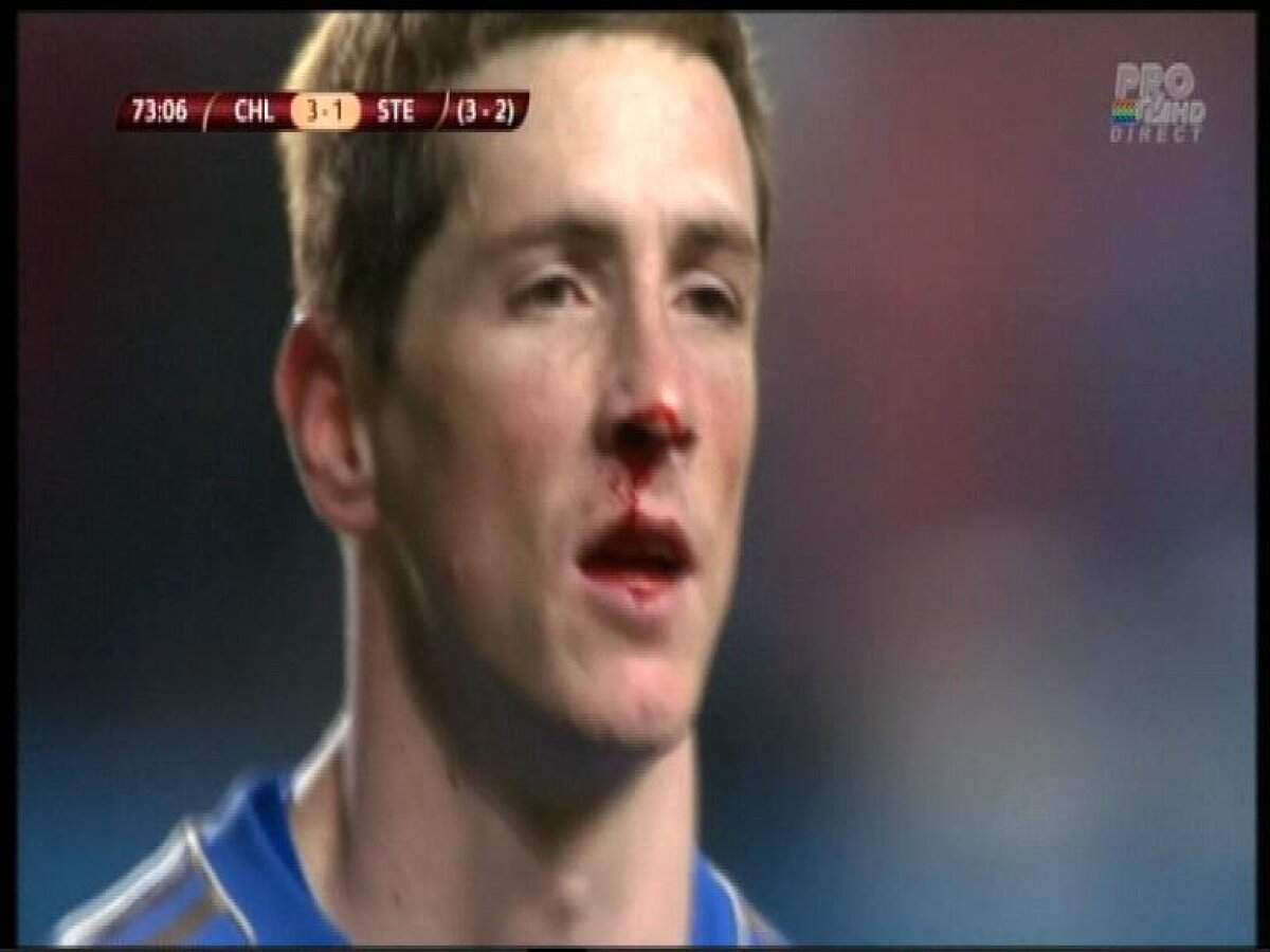 VIDEO şi FOTO Szukala l-a umplut de sînge pe Torres la o fază la care englezii au cerut penalty