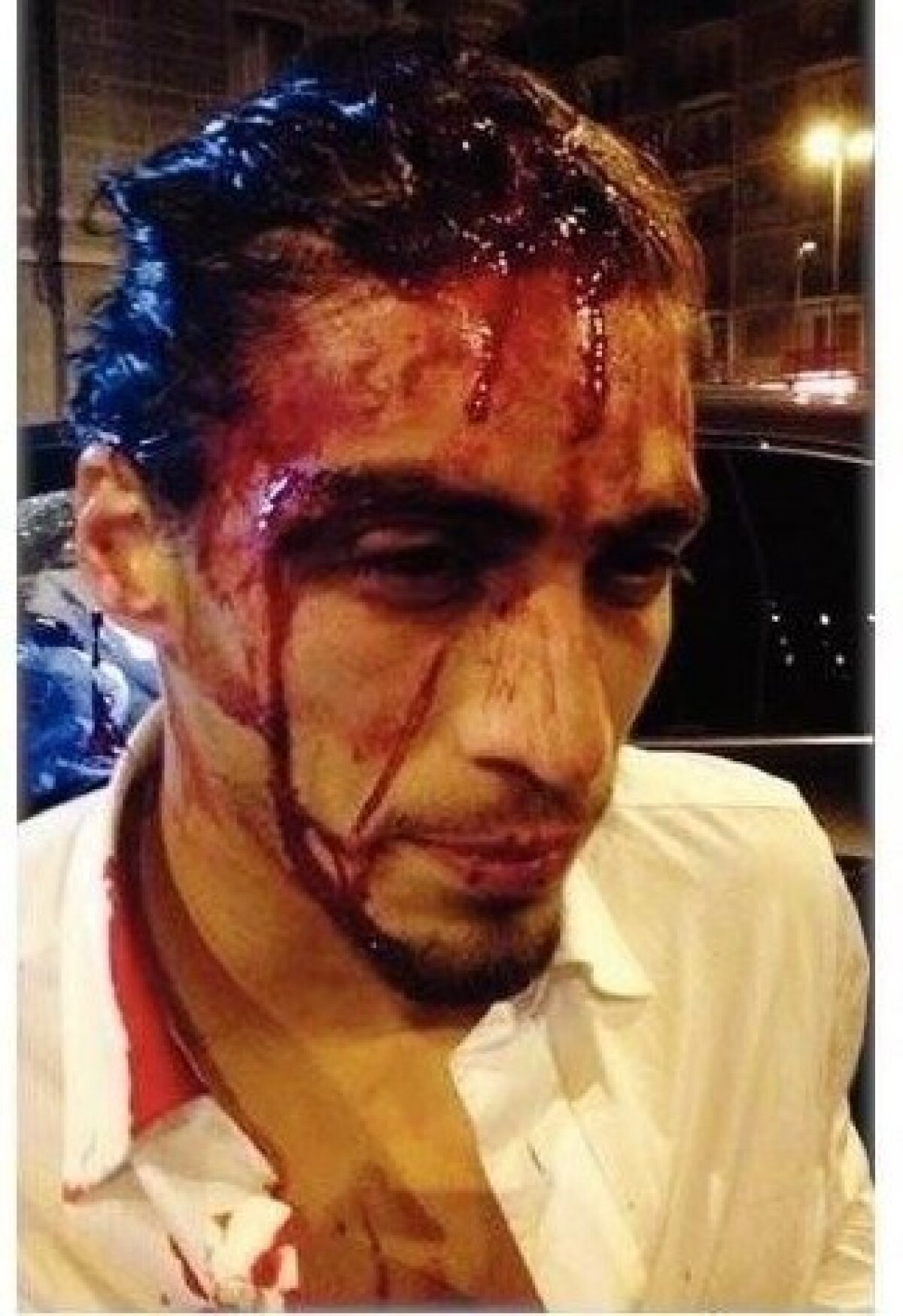 FOTO Imagini horror de la accidentul lui Caceres! Are 30 de puncte de sutură la cap