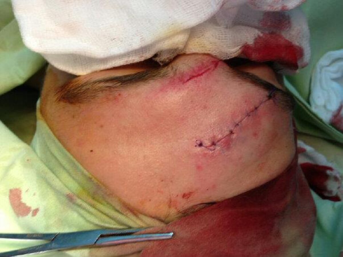 Atenţie, imagine şocantă! » Cum arată Raul Rusescu după ce-a fost făcut KO de Chipciu în meciul cu Iaşi!