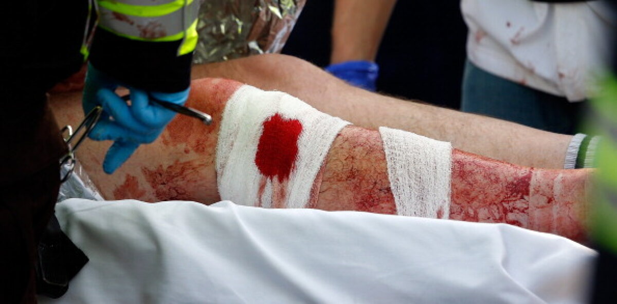 FOTO & VIDEO ATENŢIE! Galerie foto terifiantă: 3 victime şi peste 140 de răniţi în Boston » Băieţelul de 8 ani ucis de explozie a fost identificat