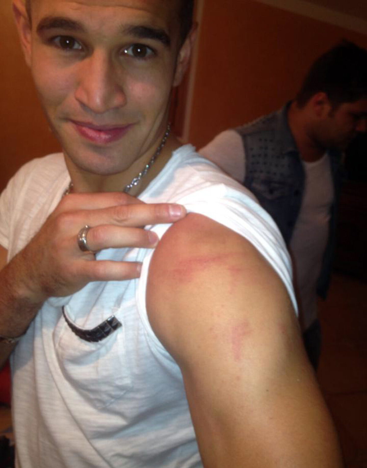 Ciudatul caz al lui ”Dracula” Bornescu » Portarul Petrolului riscă cel puţin 6 meciuri de suspendare după ce l-a muşcat pe Bawab