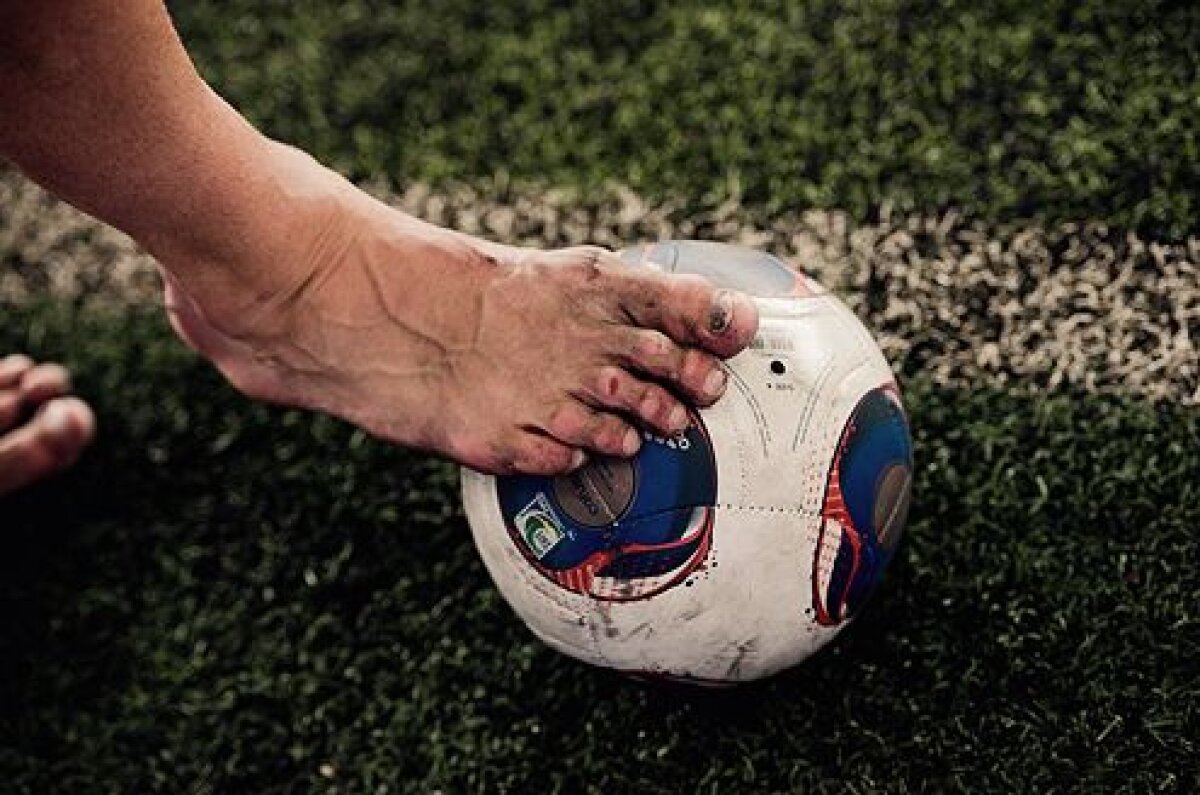 Imaginea zilei: e greu să te menţii în top! Aşa arată picioarele unui cîştigător al Ligii Campionilor!