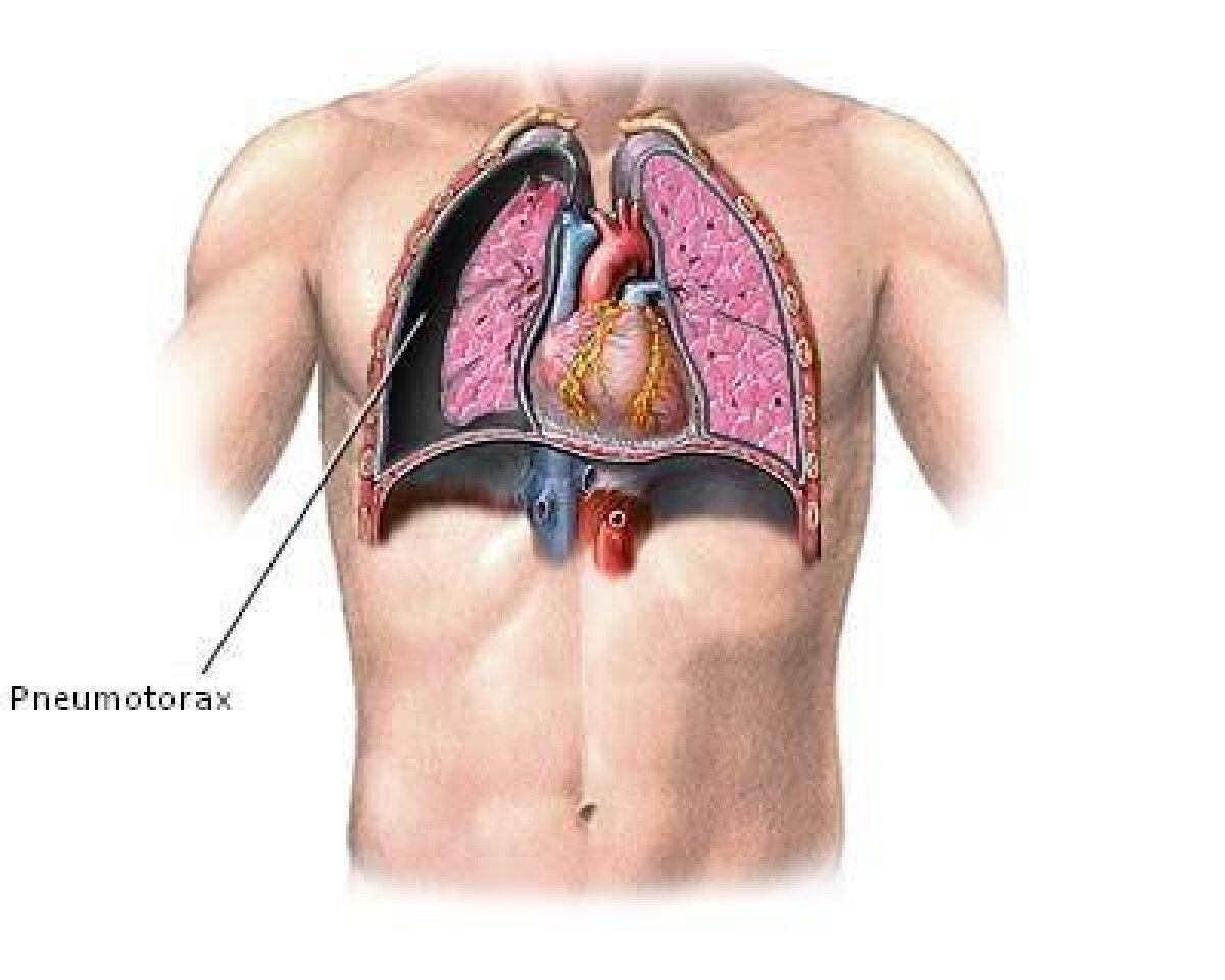 A jucat cu pneumotorax! » Siem de Jong e în spital. 6 săptămîni nu poate fi folosit de Frank de Boer