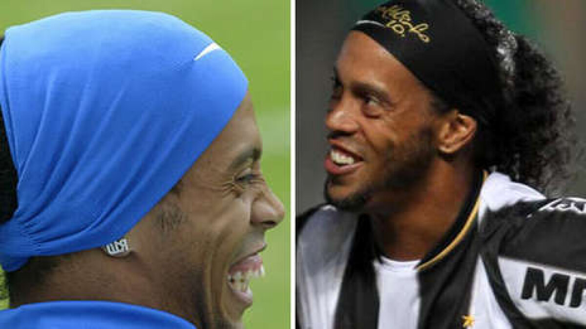 FOTO » Înainte şi după Ronaldinho nu mai e dinţos! Cum arată după intervenţia chirurgicală