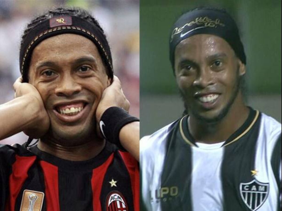 FOTO » Înainte şi după Ronaldinho nu mai e dinţos! Cum arată după intervenţia chirurgicală