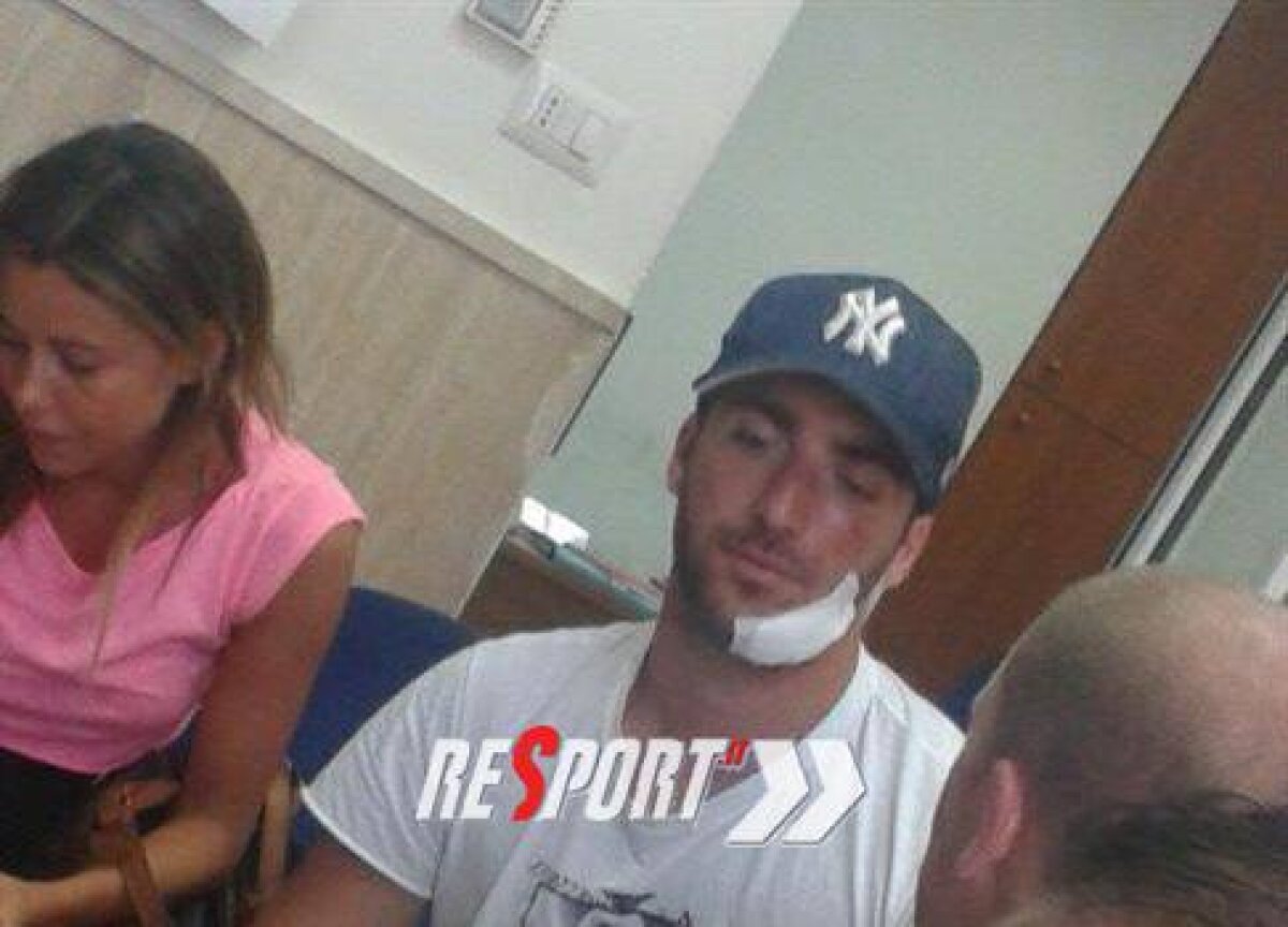 A dat cu faţa-n stîncă! » O ieşire cu barca s-a terminat prost pentru Higuain