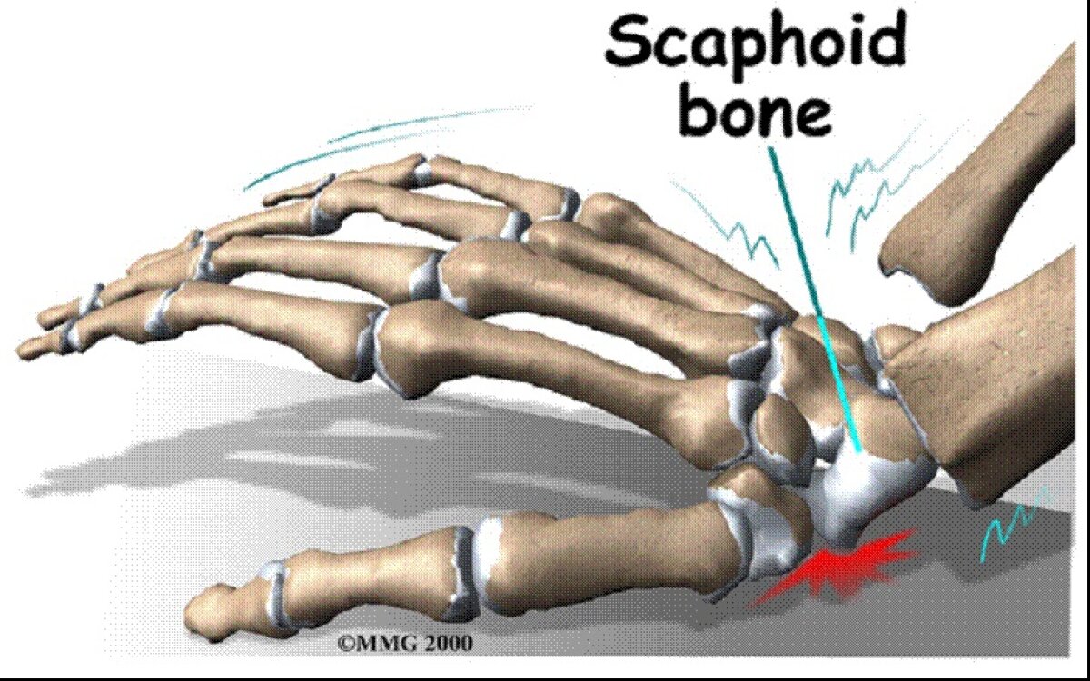 Riscă pentru ”naţională”?! » Maghiarul Szalai vine la Bucureşti deşi are o leziune la încheietura mîinii
