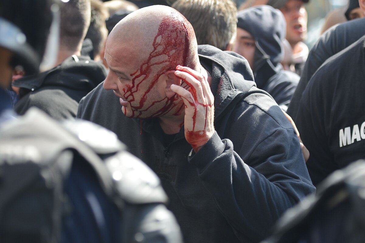 FOTO Ziua Fiarei la Bucureşti » Imagini de coşmar la sosirea maghiarilor în Bucureşti: sînge, haos şi torţe