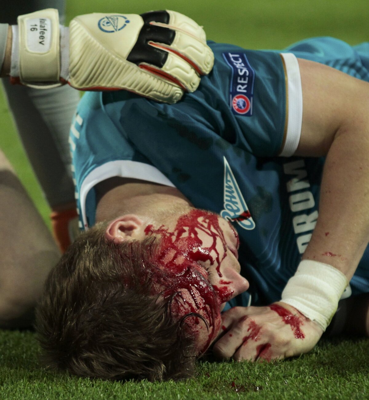 FOTO şi VIDEO Liga horror » Imagini dure: Valencia şi Hubocan au ieşit de pe teren ca după un meci de K1
