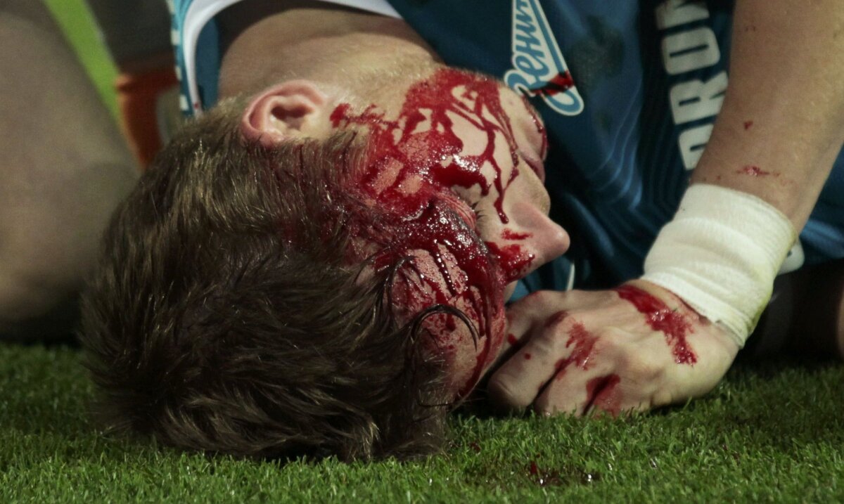 FOTO şi VIDEO Liga horror » Imagini dure: Valencia şi Hubocan au ieşit de pe teren ca după un meci de K1