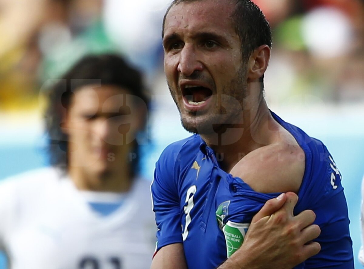 FOTO Giorgio Chiellini a fost muşcat de umăr din nou! De data aceasta, la hotel :D