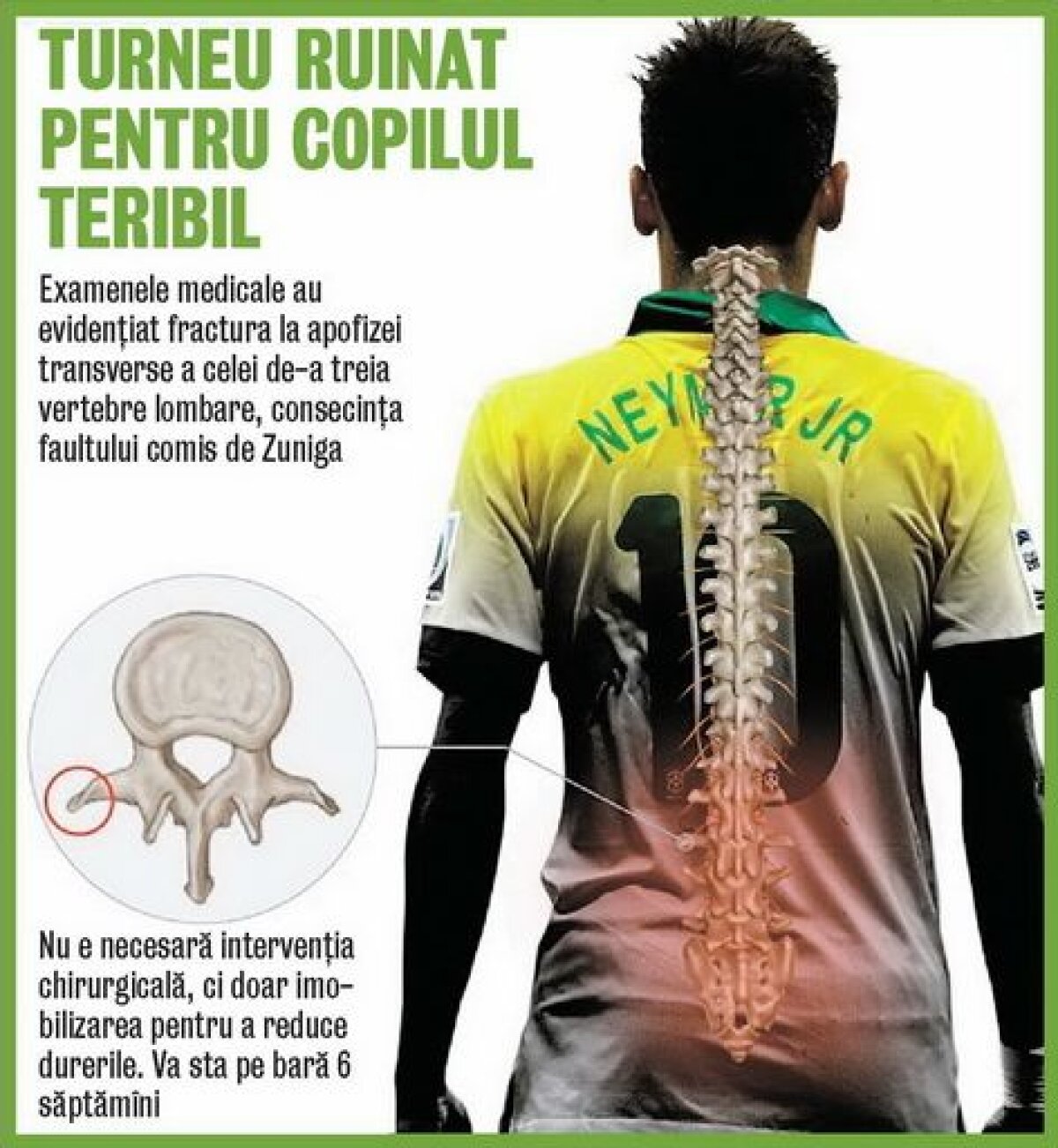 FOTO Neymartir » Brazilienii sînt revoltaţi după ce Neymar şi-a fracturat a treia vertebră lombară. Adio Mondial!