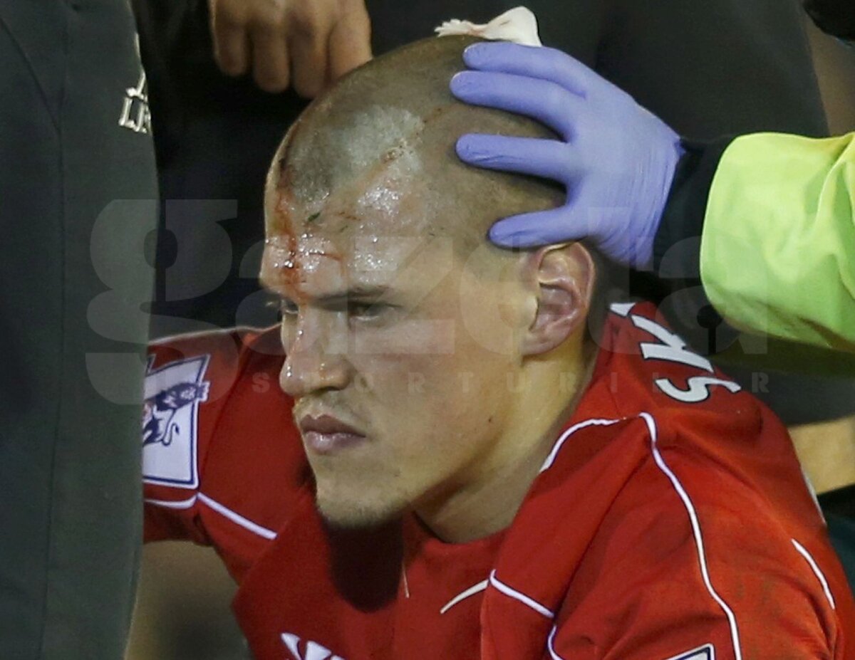 FOTO Week-end însîngerat în Premier League » Trei fotbalişti s-au lovit urît în ultima etapă