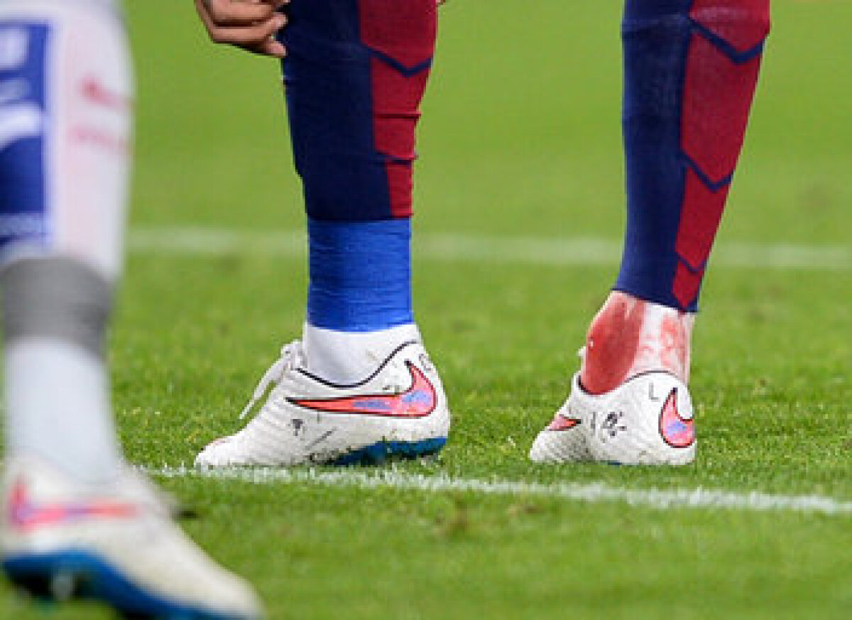 FOTO&VIDEO I-a însîngerat glezna! » Arbitrul n-a dat nimic la atacul violent al lui Gimenez la Neymar! :O