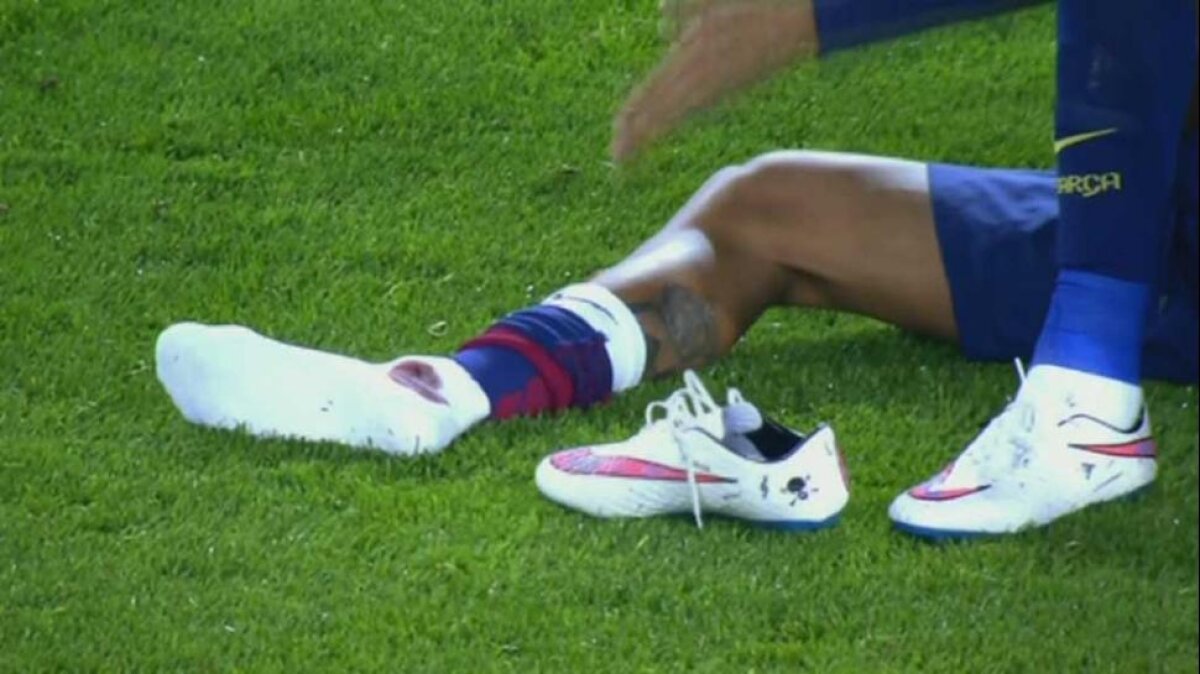 FOTO&VIDEO I-a însîngerat glezna! » Arbitrul n-a dat nimic la atacul violent al lui Gimenez la Neymar! :O