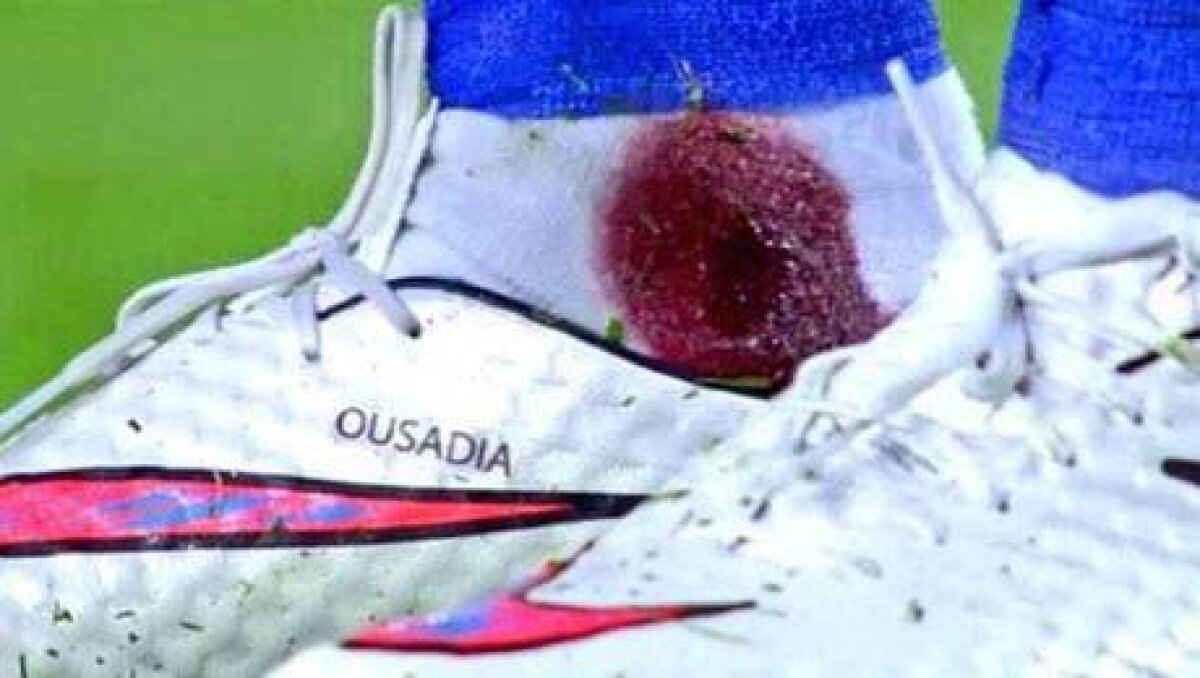 FOTO&VIDEO I-a însîngerat glezna! » Arbitrul n-a dat nimic la atacul violent al lui Gimenez la Neymar! :O