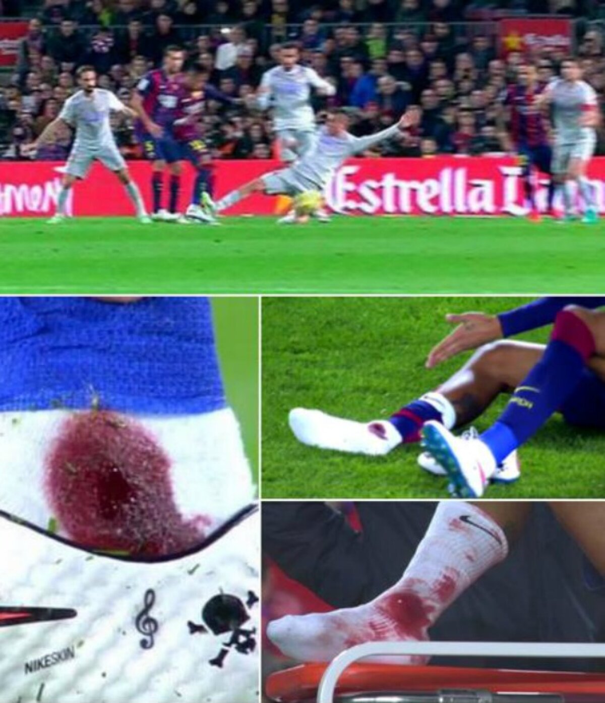 FOTO&VIDEO I-a însîngerat glezna! » Arbitrul n-a dat nimic la atacul violent al lui Gimenez la Neymar! :O