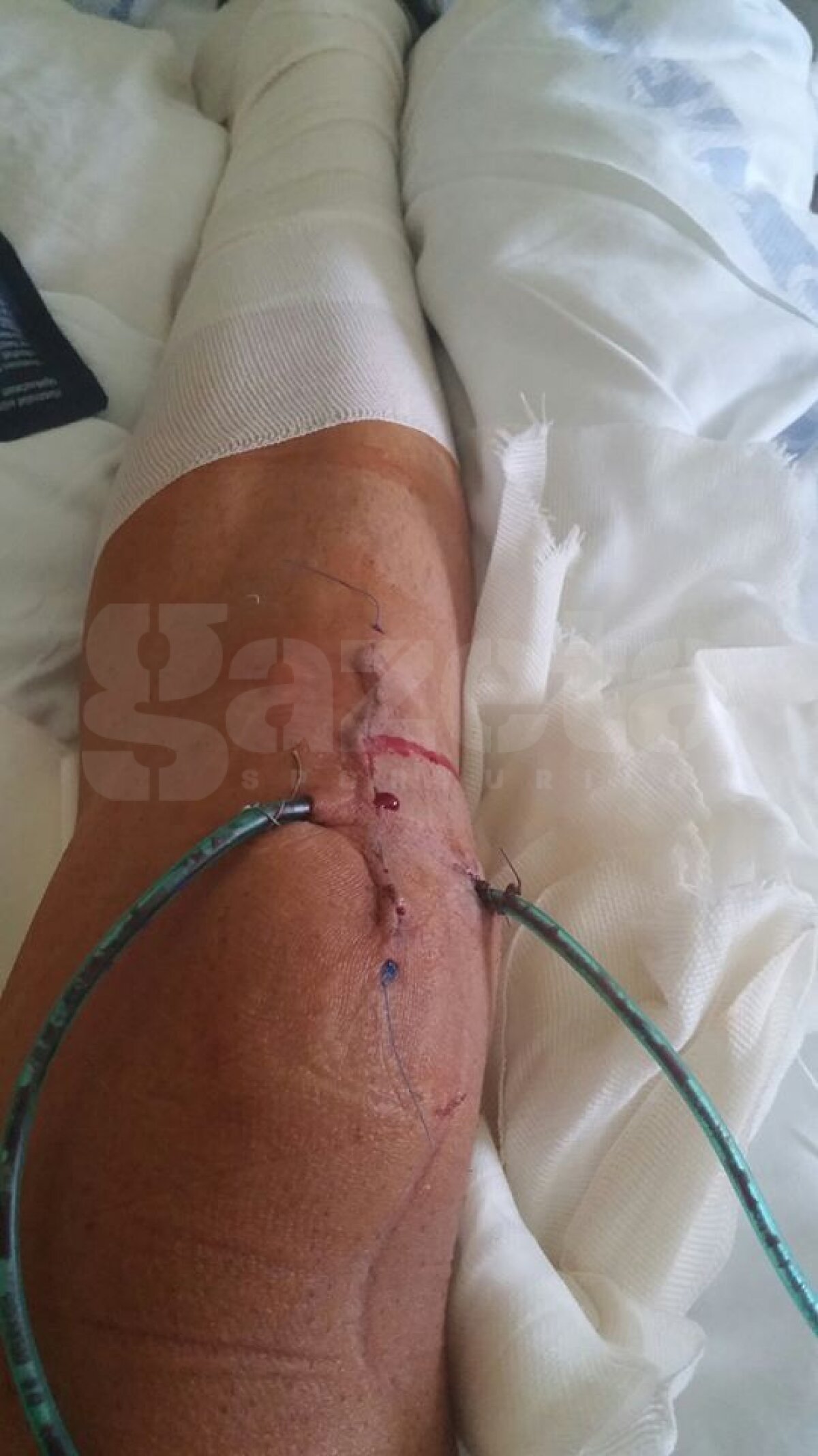 Imagine şocantă » Cum arată coşmarul unui arbitru accidentat la un meci din Liga a treia: ”Am fost cobai”