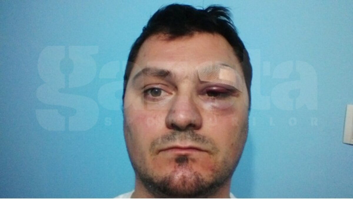 FOTO Fulgerător » Un arbitru a fost lovit de un internaţional român la un turneu amical!