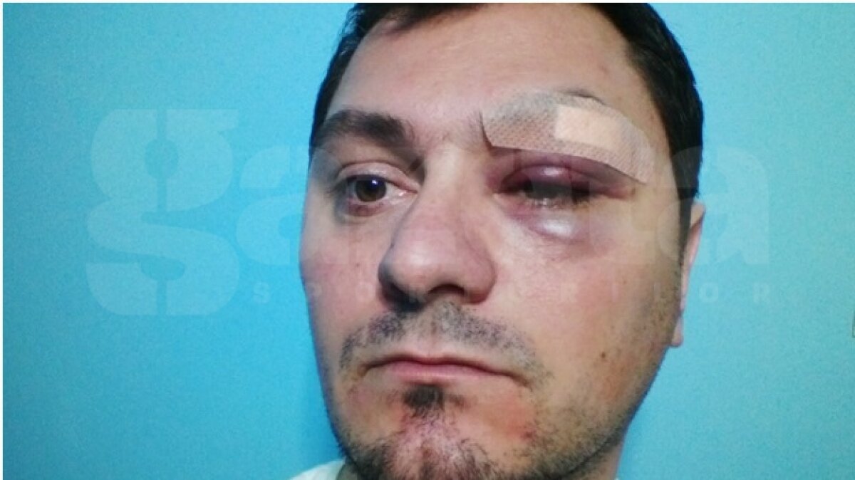 FOTO Fulgerător » Un arbitru a fost lovit de un internaţional român la un turneu amical!