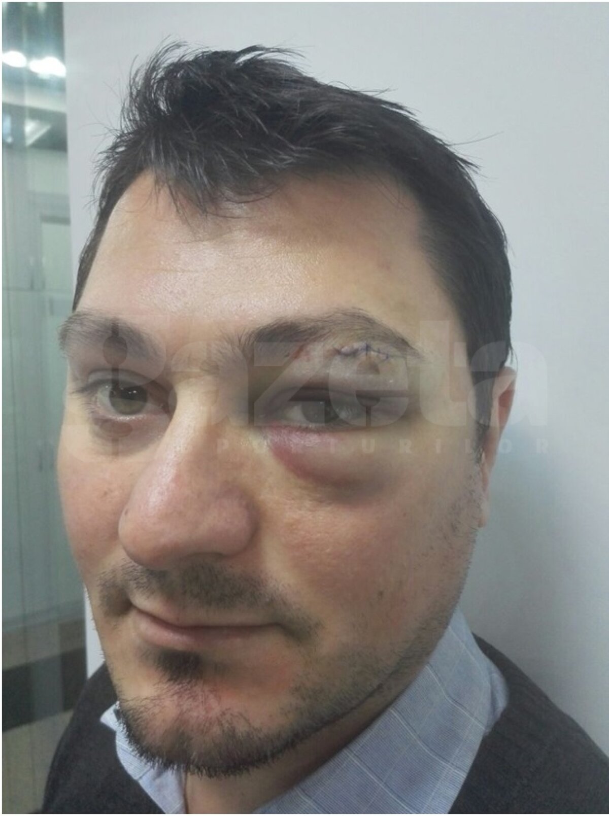 FOTO Fulgerător » Un arbitru a fost lovit de un internaţional român la un turneu amical!