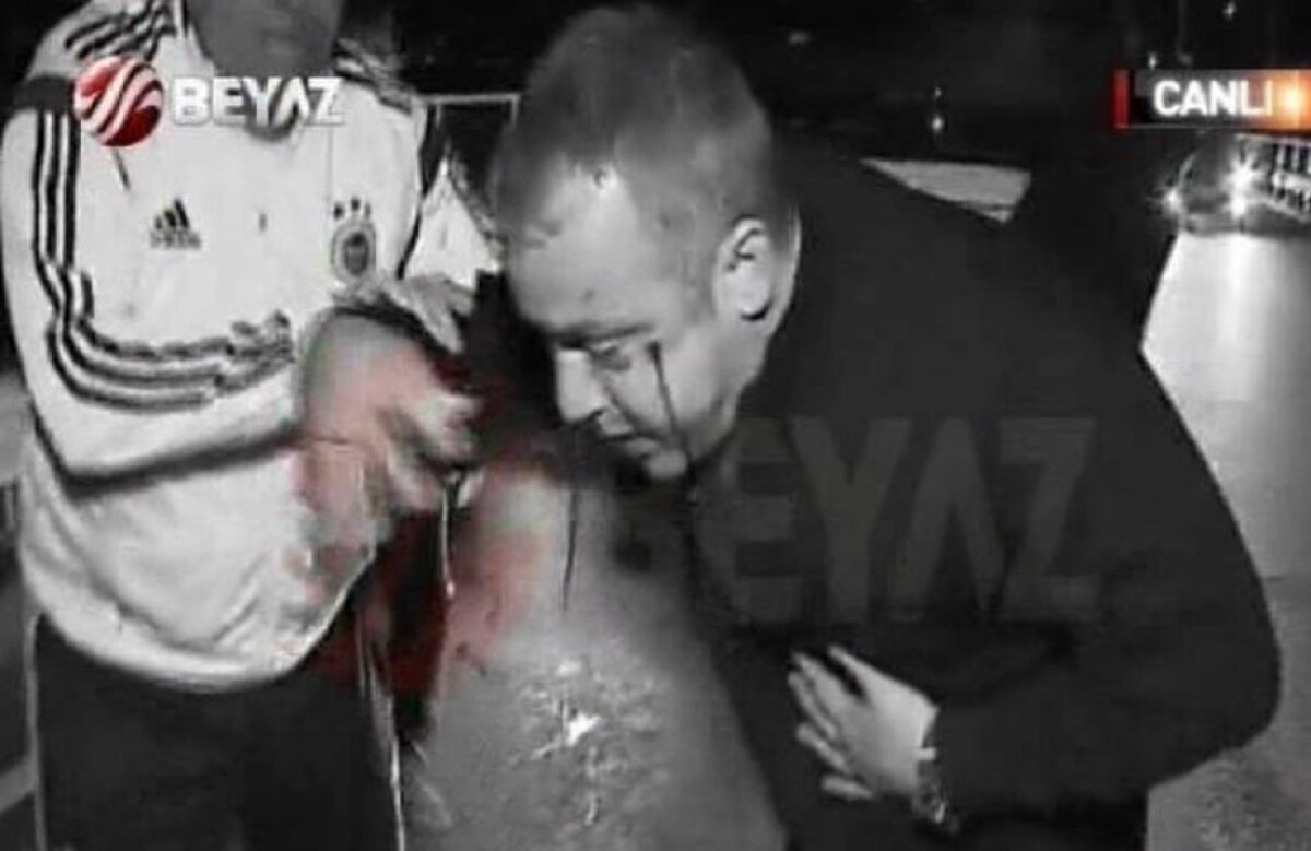 VIDEO+FOTO Ambuscadă pe autostradă » Au vrut să ucidă Fenerul! Ultraşii lui Trabzonspor au tras cu arme de vînătoare asupra autocarului lui Fenerbahce