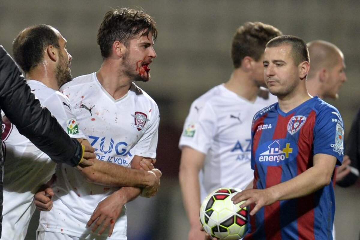 Scene tensionate la Rapid - ASA Tîrgu Mureş » Edu Oriol a rămas fără un dinte şi a părăsit terenul plin de sînge