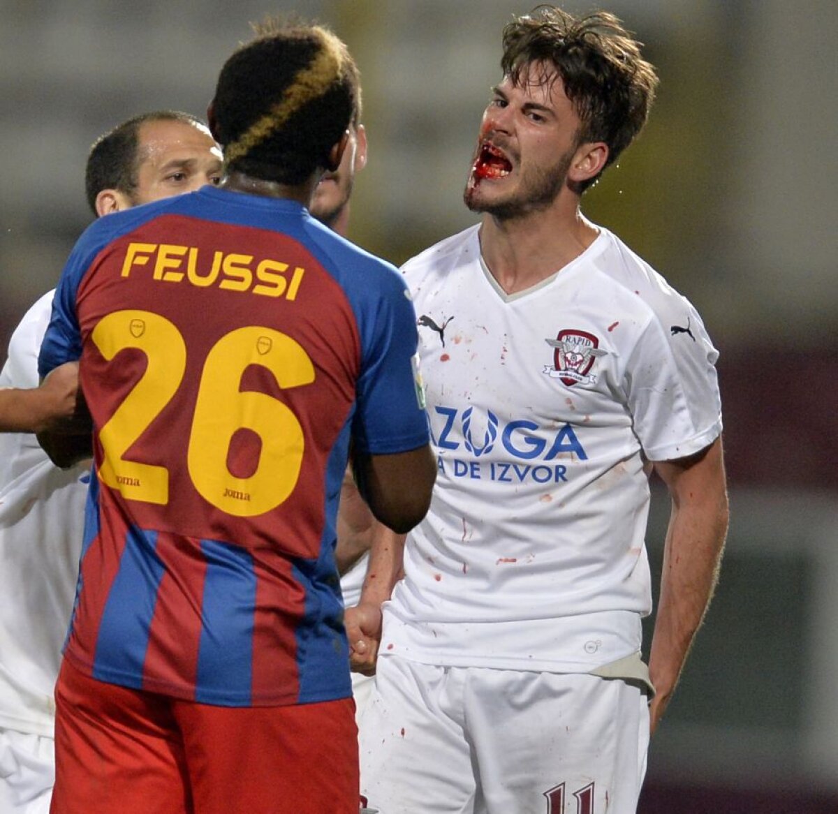 Scene tensionate la Rapid - ASA Tîrgu Mureş » Edu Oriol a rămas fără un dinte şi a părăsit terenul plin de sînge