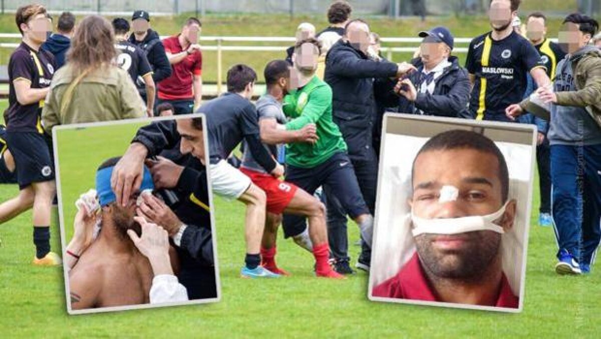 GALERIE FOTO Meciul groazei  în Germania: un fotbalist riscă să-și piardă un ochi după ce a fost snopit în bătaie. Atenție, imagini dure!